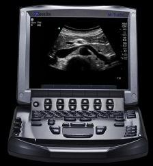 SonoSite M Turbo ultrasound system