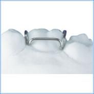 Adams Clasp Retainer