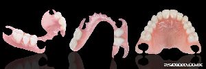 flexible denture