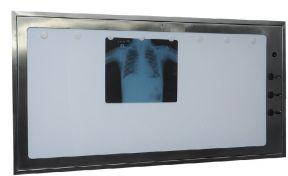 X-ray Film Viewer