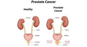 stone and prostate laser surgery center