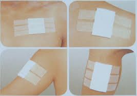 Ticerin Plus Triple Antibiotic Dressing Tapes