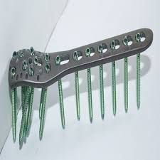 Orthopedic Implants