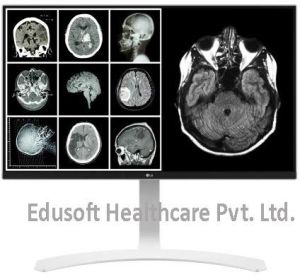 LG 1.3MP & LG 8MP Clinical Review Monitor