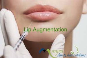 lip enhancement