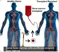 Bone Marrow Transplant In Delhi