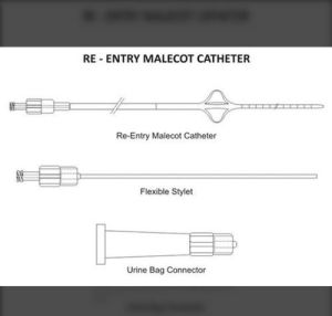 Re-entry Malecot Catheter