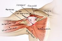 Shoulder Impingement Syndrome Surgery