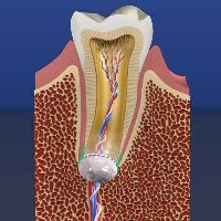 Regenerative Endodontics