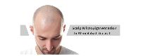 SCALP MICROPIGMENTATION