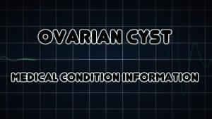 Ovarian Cysts Treatment Service