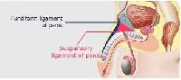 Penile Lengthening Surgery In India