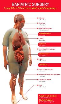 Bariatric Surgery Treatment Services