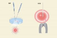 Best IVF Treatment India