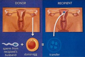 Sperm Donation in Surat