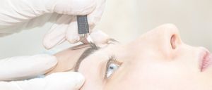 eye brow transplant