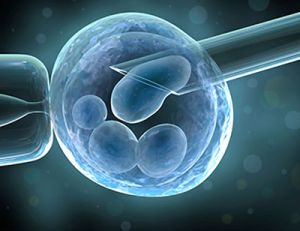 Intra-Cytoplasmic Sperm Injection