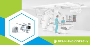 Brain Angiography Testing Services