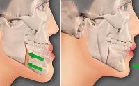 Oral and Maxillofacial Surgery