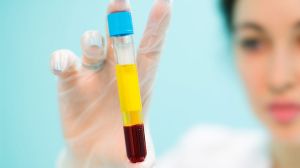 Platelet Rich Plasma Stem Cell Treatment Services