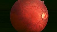 Retinitis Pigmentosa Stem Cell Treatment Services