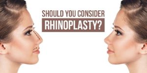 rhinoplasty