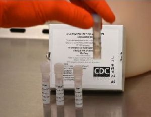 RT-PCR test kit