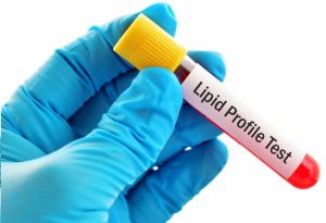 lipid profile test