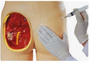 Intramuscular Injection Training Model