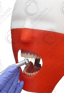 Restorative dental phantom head manikin