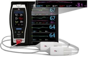 Cerebral Oximetry