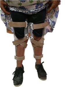 Knock Knee Orthosis Braces