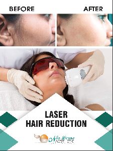 Laser Hair Removal Services