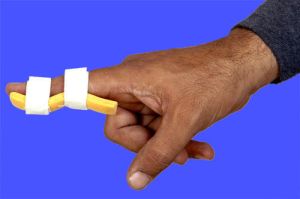 Mallet Finger Splint