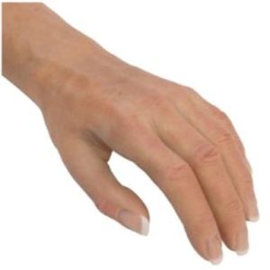 Silicone Hand Prosthesis