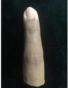 Index Finger Prosthesis