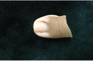 Toe prosthesis