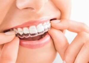 orthodontic treatments services