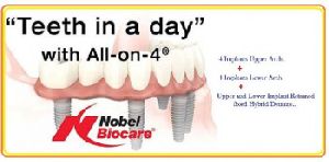 Dental Implant treatment in Delhi.