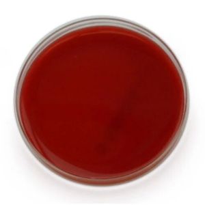 Sheep Blood Agar Plate