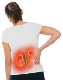 Stem Cell Therapy for Chronic Kidney