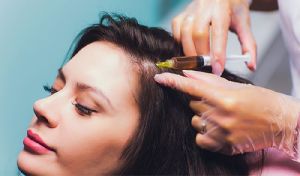 PRP Hair Treatment in Chennai