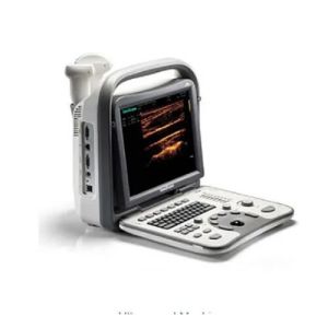 3D ultrasound machine