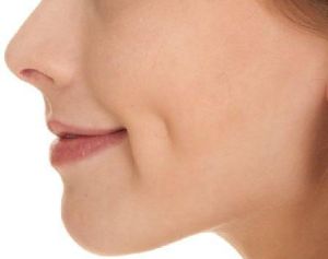 Dimple Creation Treatment