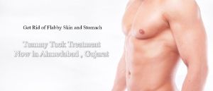 Tummy Tuck (Abdominoplasty)