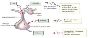 Hyperprolactinemia Treatment