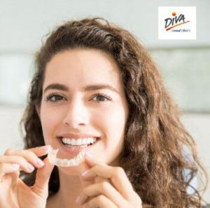 Clear Aligners Services