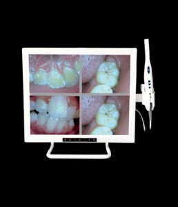 Intraoral Camera with LCD Screen