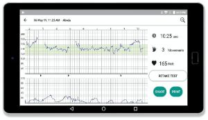 smart ctg machine