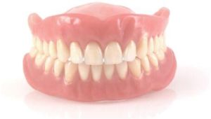 Flexible Partial Denture